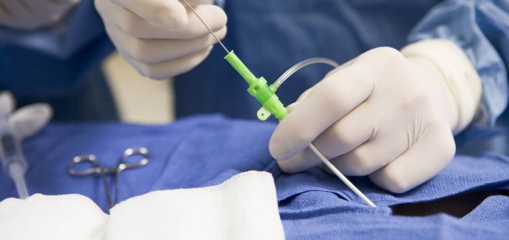 Angiography and Angioplasty Are Not the Same Procedure — What Patients Need to Understand Before They Consent